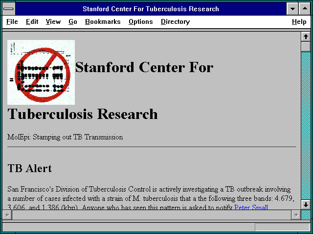 Screenshot of Stanford Center For Tuberculosis Research