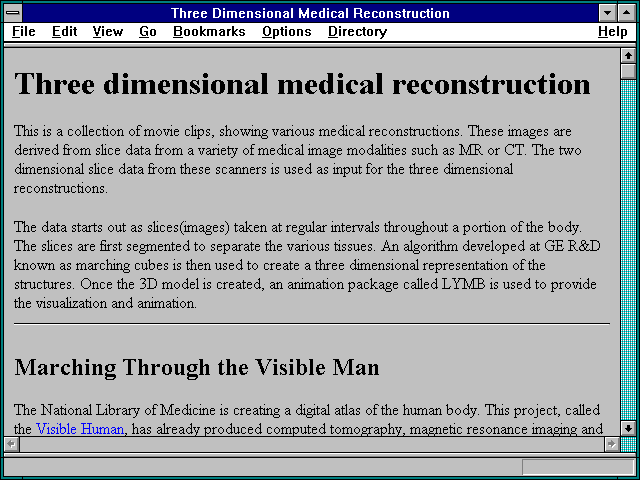 Screenshot of Three Dimensional Medical Reconstruction